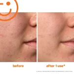 KS202301_ExfoliKate_B_A-min_40be4b6c-6219-4f82-aff0-5cda6c51b3d3_result