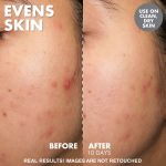 YOGLOWREPROMOTEPDPEVENSSKIN