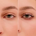 Before_and_after_rollerlash