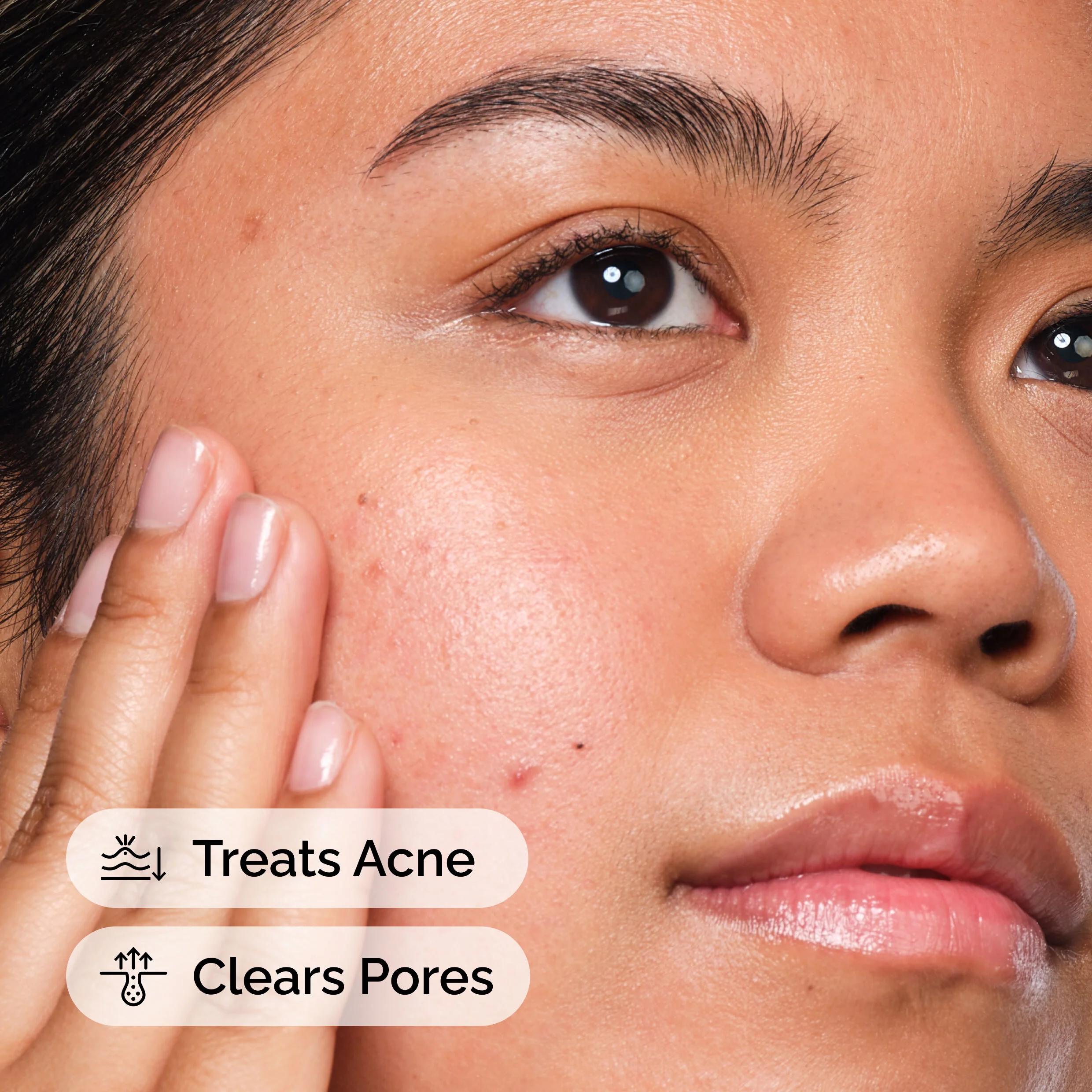 The Ordinary Salicylic Acid 2% Solution - 30ml - Image 2
